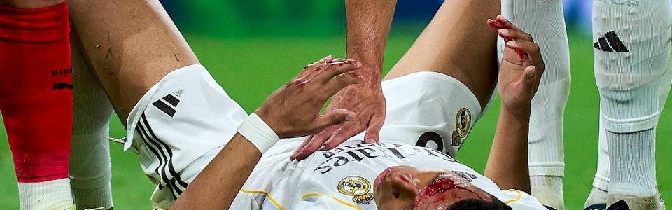 争议再起！姆巴佩受伤流血，主裁拒判点球，皇马官方强烈指责西甲暗箱操作