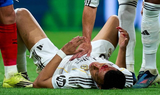 争议再起！姆巴佩受伤流血，主裁拒判点球，皇马官方强烈指责西甲暗箱操作